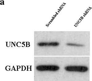 Detection of Mouse UNC5H2/UNC5B by Western Blot
