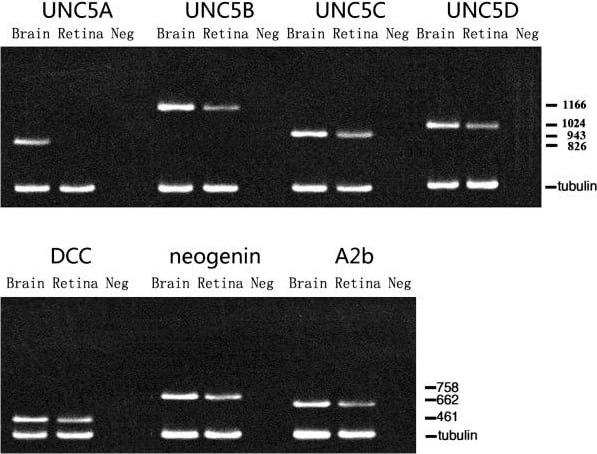 Detection of Mouse UNC5H2/UNC5B by Western Blot