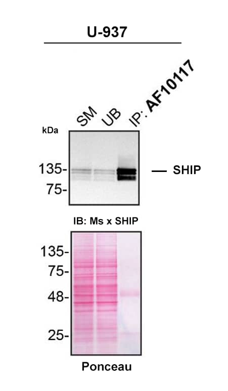 Detection of SHIP by Immunoprecipitation.
