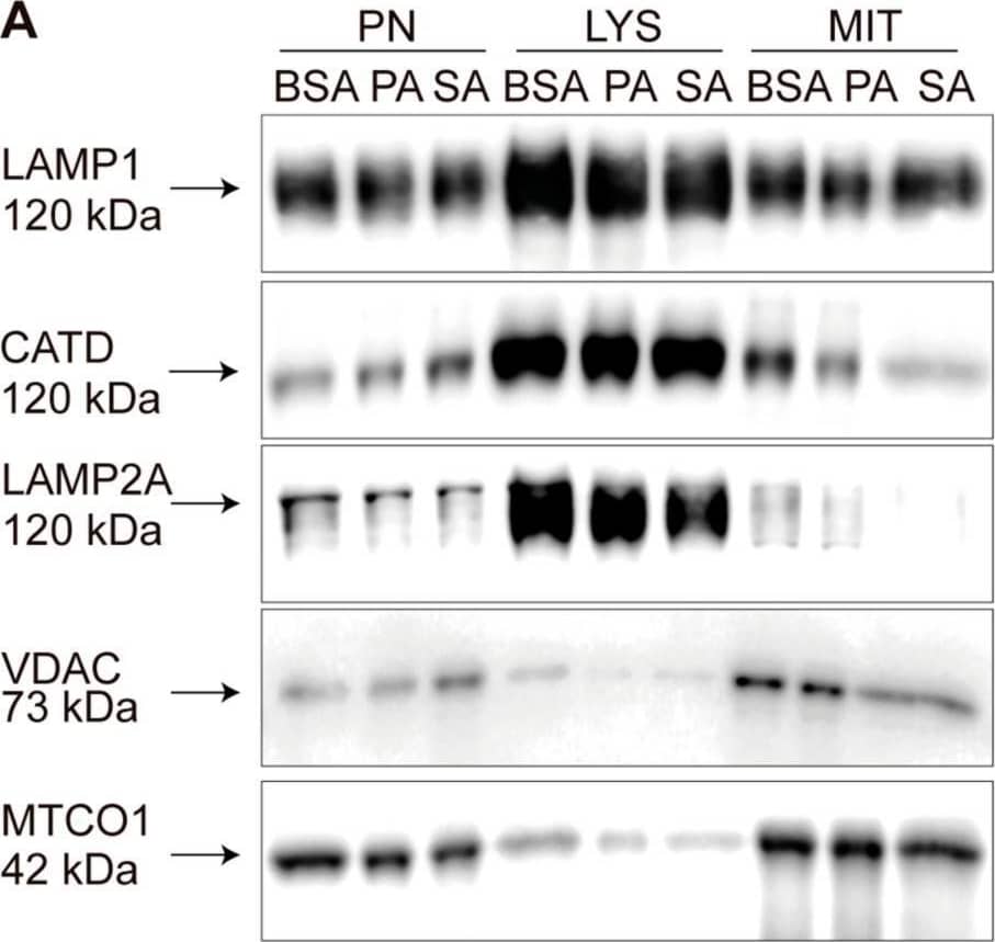 Detection of Cathepsin D by Western Blot