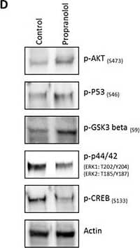Detection of Human ERK1/ERK2 by Western Blot