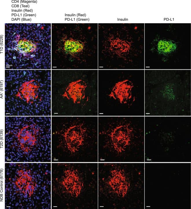 Detection of Human PD-L1 by Immunocytochemistry/ Immunofluorescence