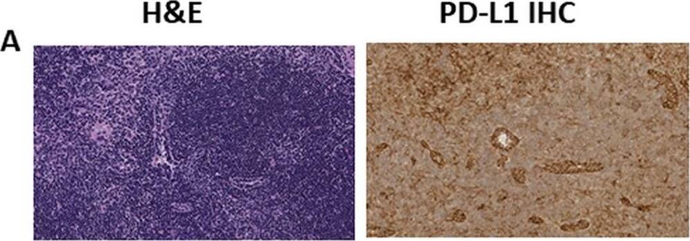 Detection of Mouse Mouse PD-L1/B7-H1 Antibody by Immunohistochemistry