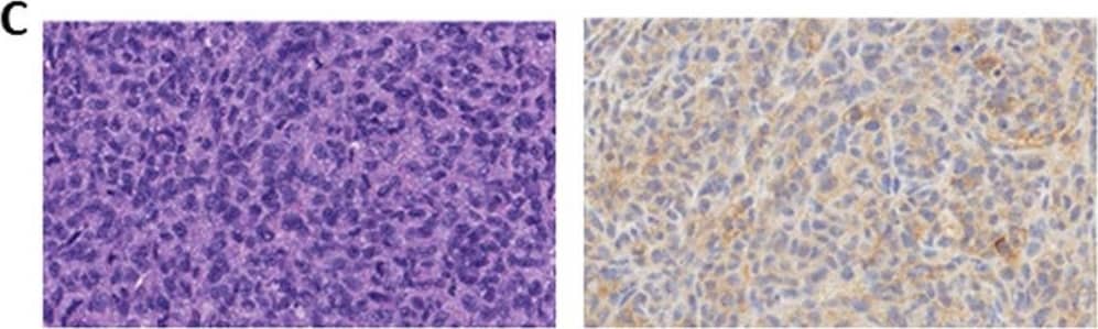 Detection of Mouse Mouse PD-L1/B7-H1 Antibody by Immunohistochemistry