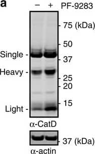 Detection of Human Cathepsin D by Western Blot