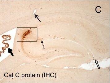 Detection of Mouse Cathepsin C/DPPI by Immunohistochemistry