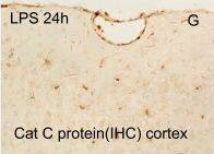 Detection of Mouse Cathepsin C/DPPI by Immunohistochemistry