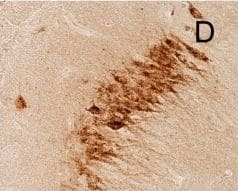 Detection of Mouse Cathepsin C/DPPI by Immunohistochemistry