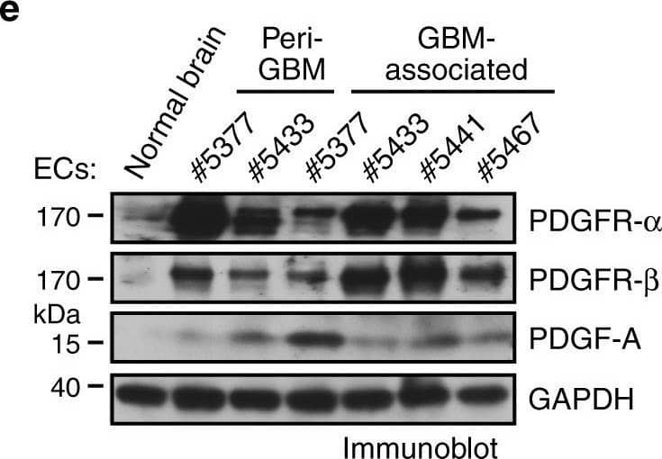 Detection of Human PDGF R beta by Western Blot