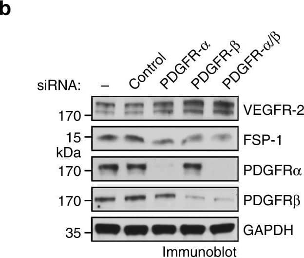 Detection of Mouse PDGF R beta by Western Blot
