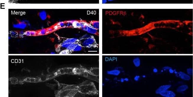 Detection of PDGF R beta by Immunohistochemistry