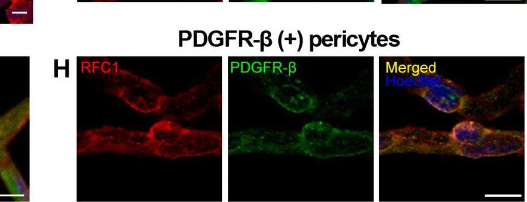 Detection of Mouse PDGF R beta by Immunohistochemistry