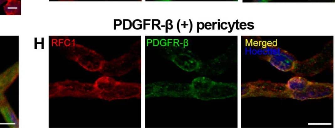 Detection of Mouse PDGF R beta by Immunohistochemistry