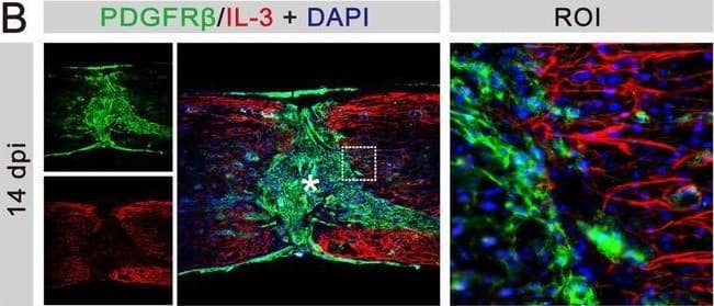 Detection of PDGF R beta by Immunohistochemistry