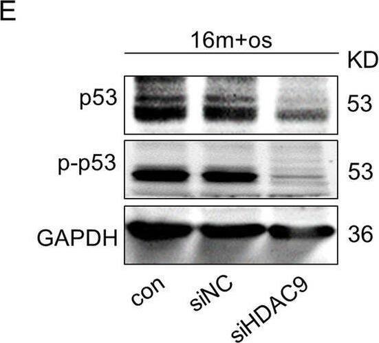 Detection of Phospho-p53 (S15) by Western Blot