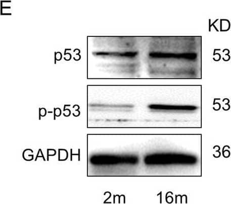 Detection of Phospho-p53 (S15) by Western Blot