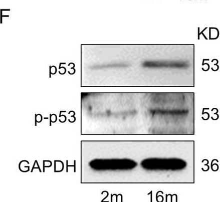 Detection of Phospho-p53 (S15) by Western Blot