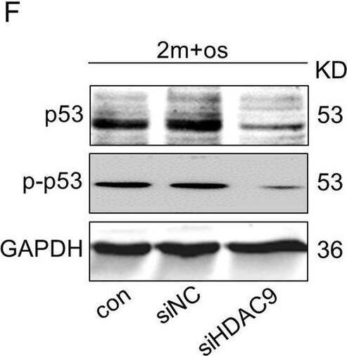 Detection of Phospho-p53 (S15) by Western Blot