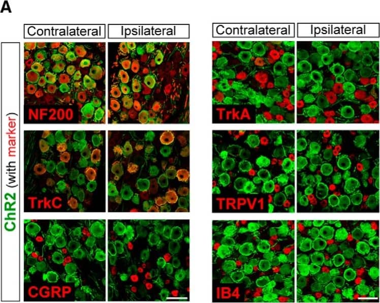 Detection of Porcine TrkA by Immunohistochemistry