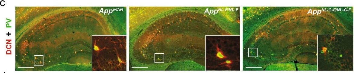 Detection of Mouse Decorin by Immunohistochemistry