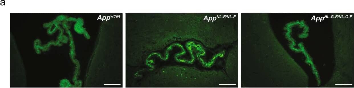 Detection of Mouse Decorin by Immunohistochemistry
