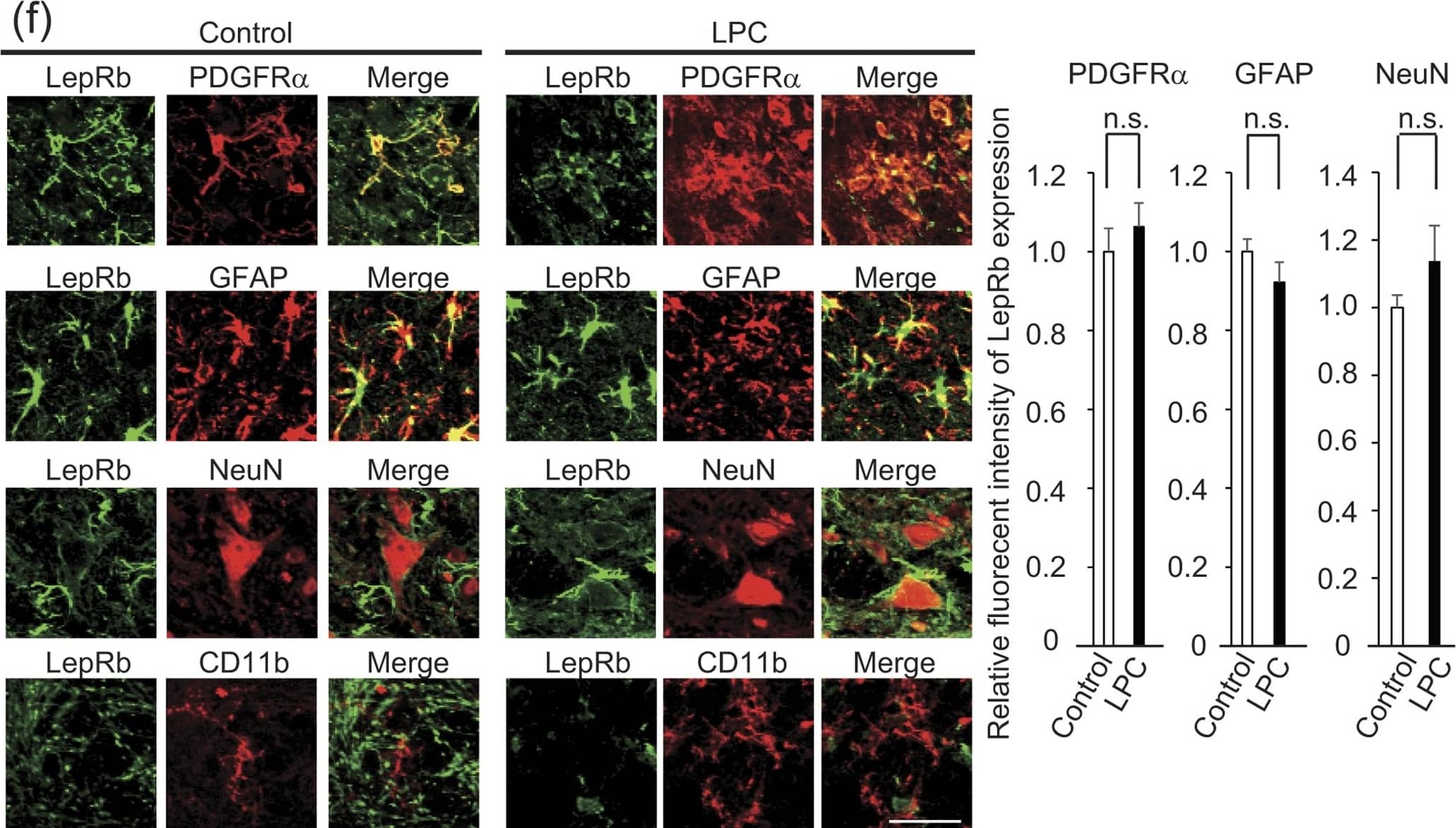 Detection of Mouse PDGFR alpha by Immunocytochemistry/Immunofluorescence