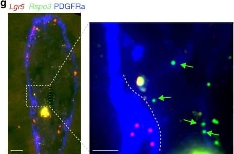 Detection of Mouse PDGFR alpha by Immunocytochemistry/Immunofluorescence