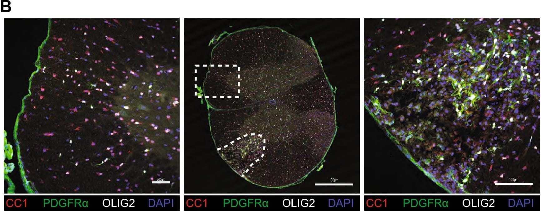 Detection of Mouse PDGFR alpha by Immunohistochemistry