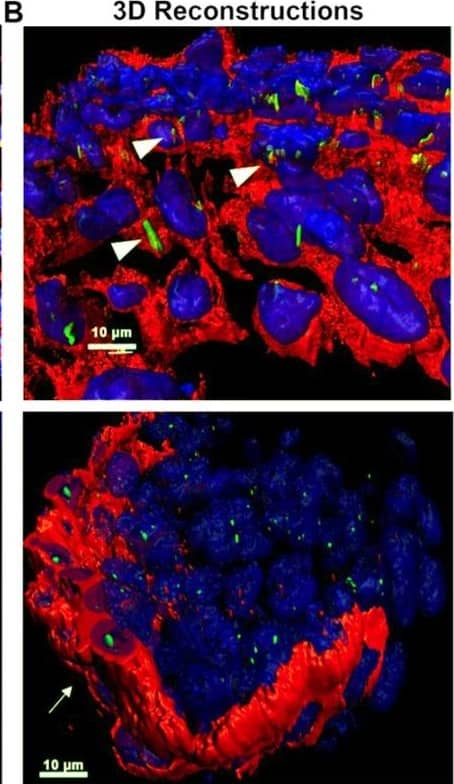 Detection of Mouse PDGFR alpha by Immunohistochemistry