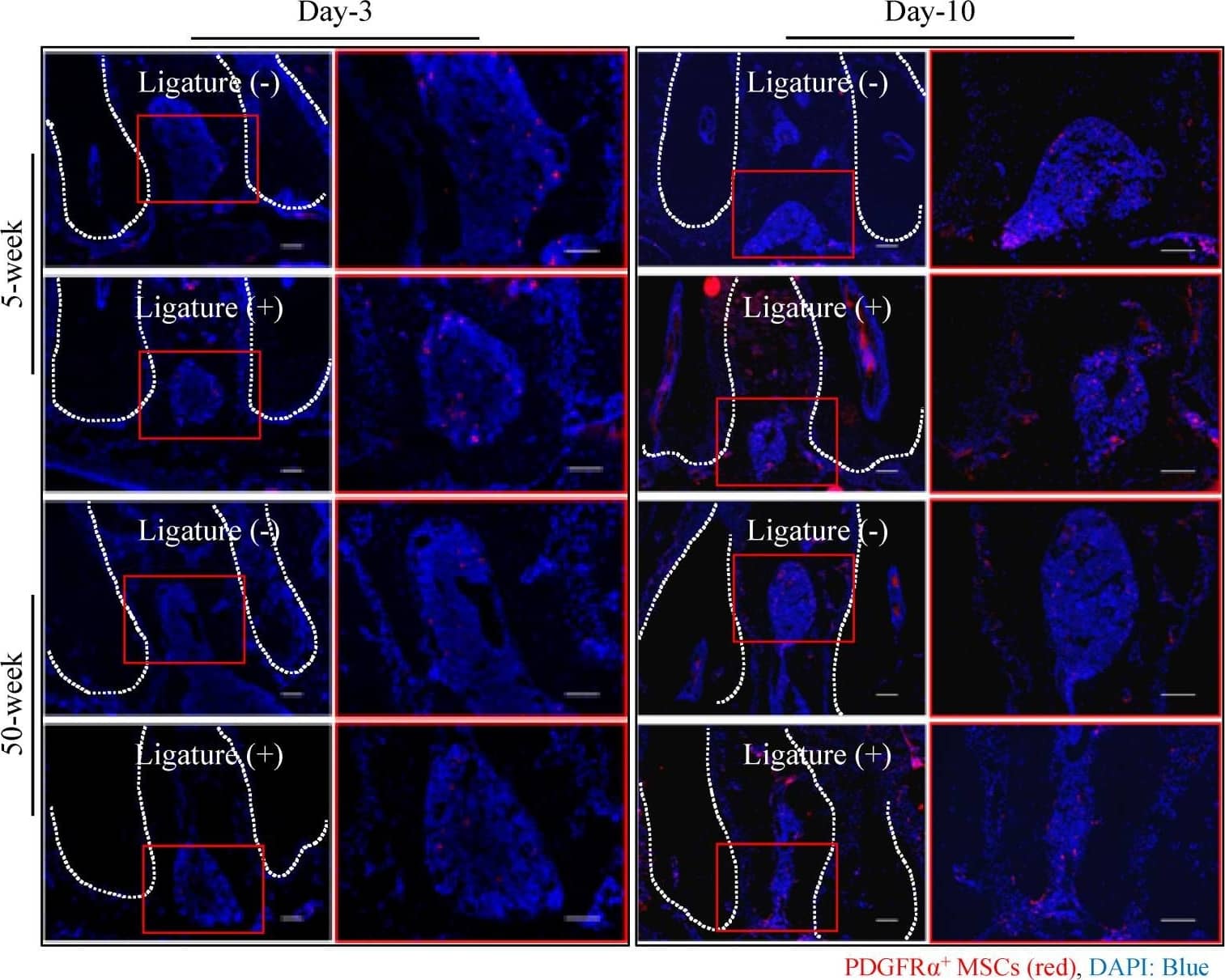 Detection of Mouse PDGFR alpha by Immunohistochemistry