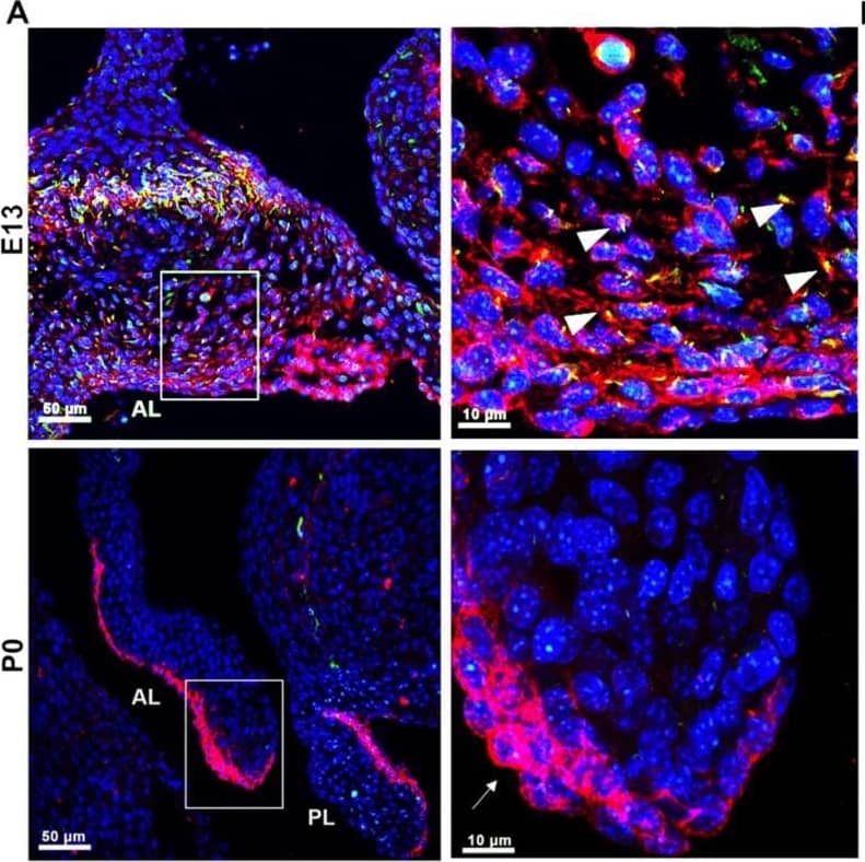 Detection of Mouse PDGFR alpha by Immunohistochemistry