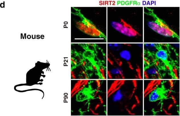 Detection of Mouse PDGFR alpha by Immunohistochemistry