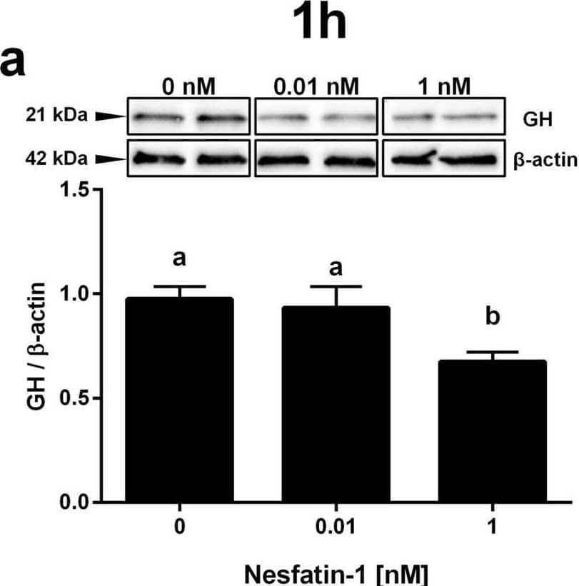 Detection of Growth Hormone by Western Blot