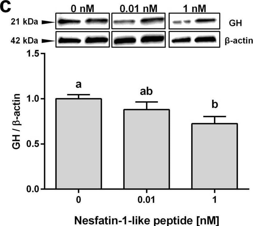 Detection of Growth Hormone by Western Blot