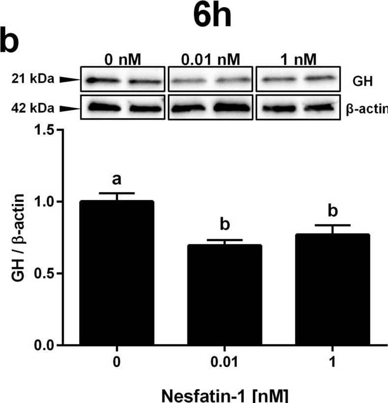 Detection of Growth Hormone by Western Blot