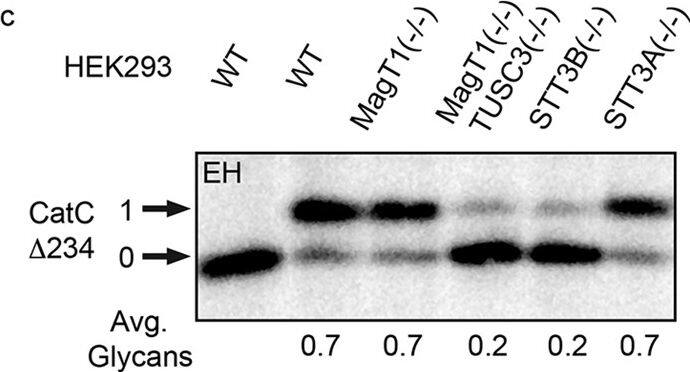 Detection of Human Cathepsin C/DPPI by Western Blot