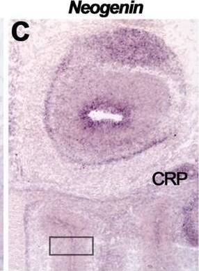 Detection of Neogenin by Immunohistochemistry