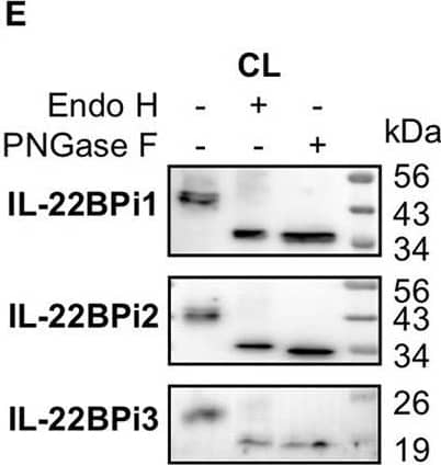 Detection of Human IL-22BP/IL22 RA2 by Western Blot