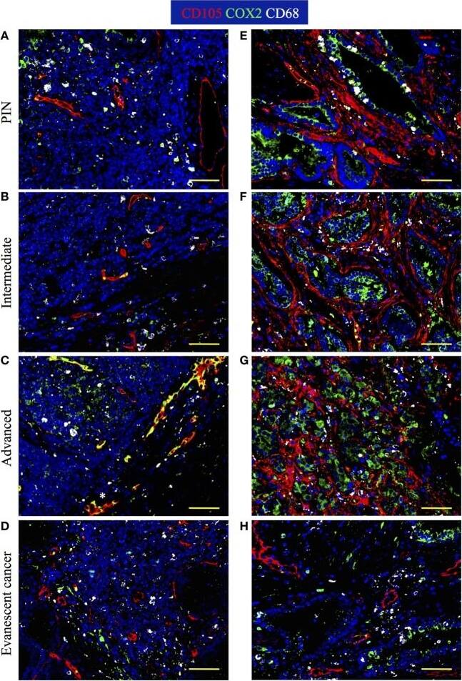 Detection of Human Endoglin/CD105 by Immunocytochemistry/Immunofluorescence