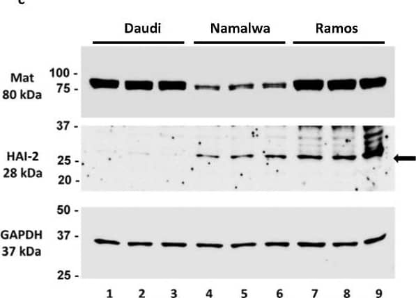 Detection of HAI-2 by Western Blot