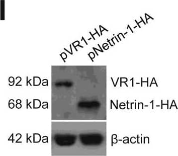 Detection of Human Netrin-1 by Western Blot