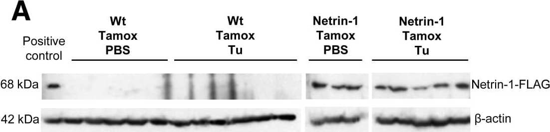 Detection of Mouse Netrin-1 by Western Blot