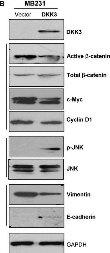 Detection of Human Dkk-3 by Western Blot