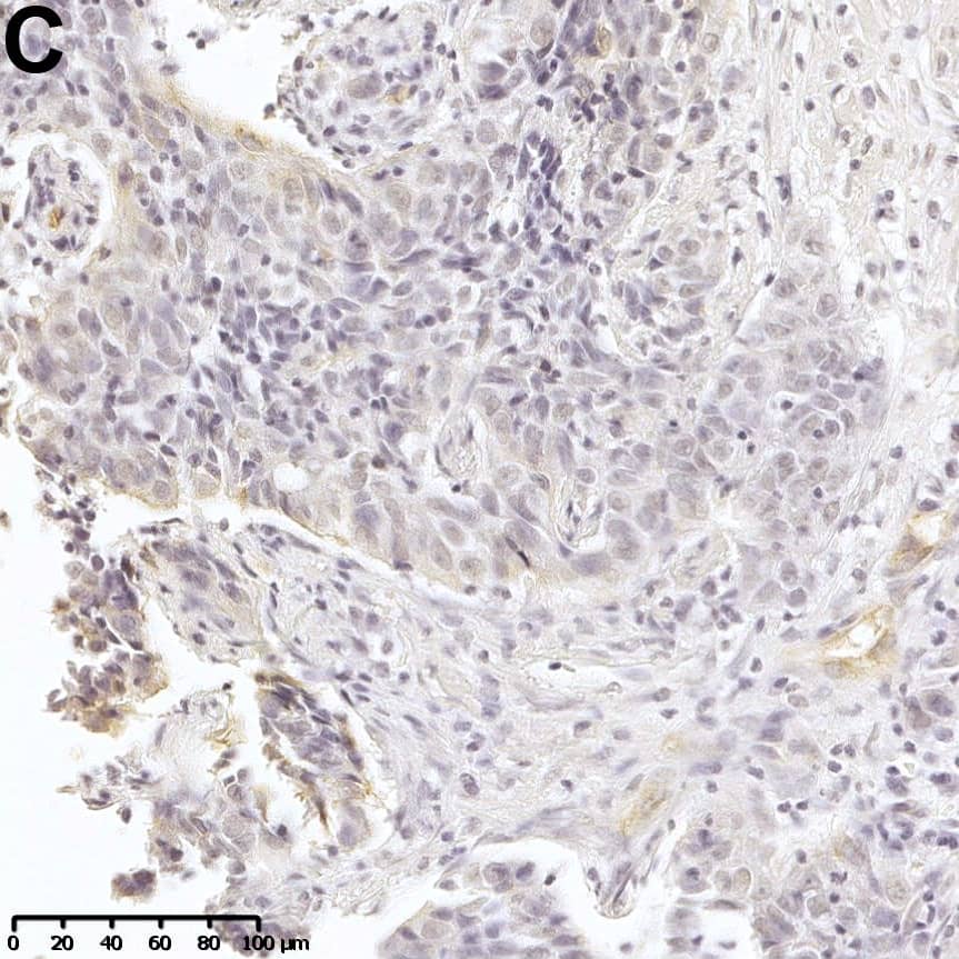 Detection of Human Dkk-3 by Immunohistochemistry
