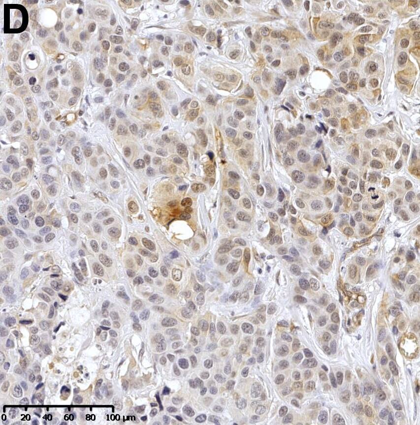 Detection of Human Dkk-3 by Immunohistochemistry