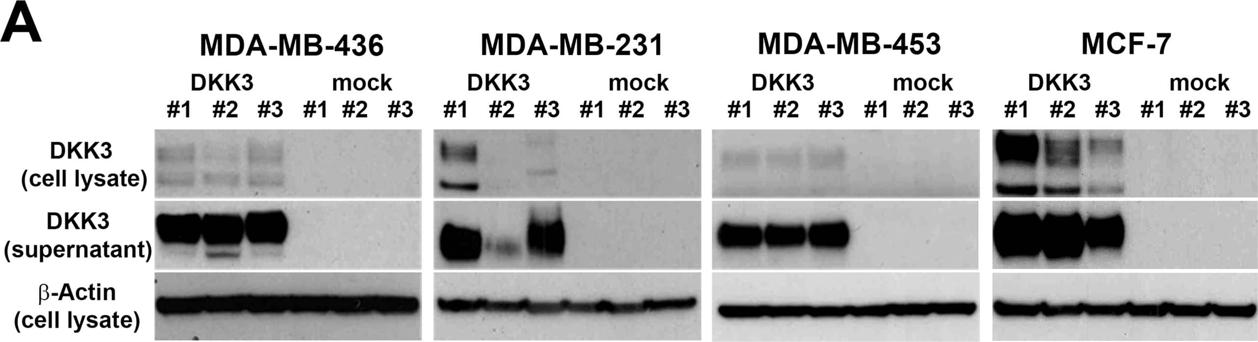 Detection of Human Dkk-3 by Western Blot