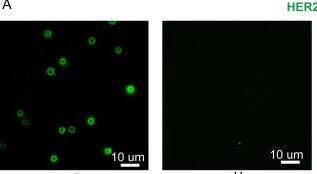 Detection of ErbB2/Her2 by Immunocytochemistry/ Immunofluorescence