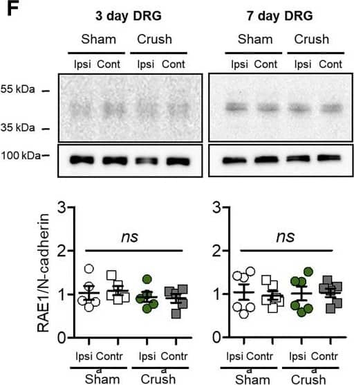 Detection of Mouse Rae-1 by Western Blot