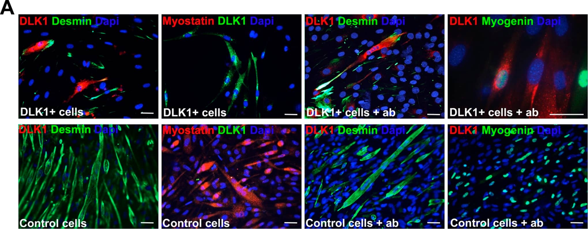 Detection of Mouse Pref-1/DLK1/FA1 by Immunocytochemistry/ Immunofluorescence