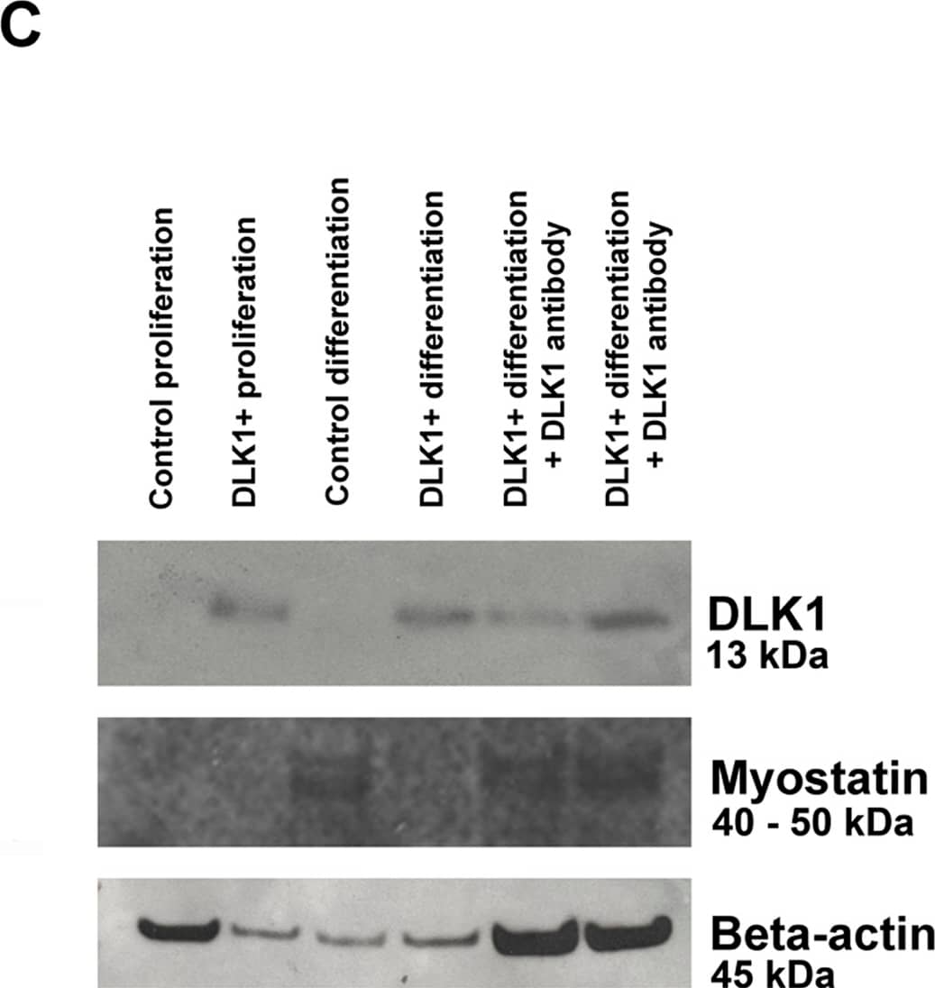 Detection of Mouse Pref-1/DLK1/FA1 by Western Blot